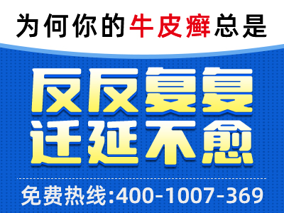 银屑病复发的预防和控制方法